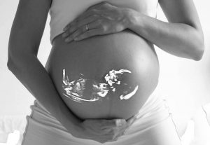 COVID 19 complicaciones en algunos bebes aunque no es grave para las embarazadas 1